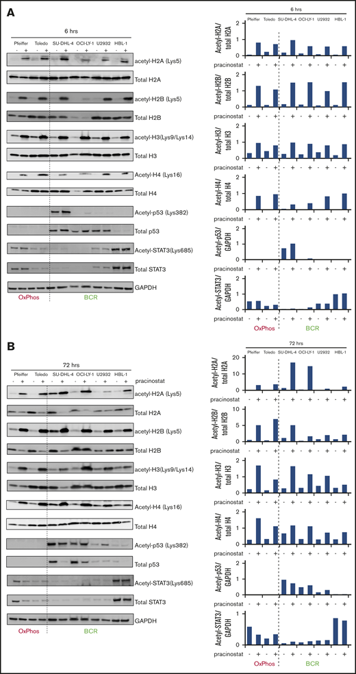 Pracinostat induces acetylation of core histones and nonhistone proteins. DLBCLs were treated with DMSO (–) or pracinostat (+) for 6 hours (A) or 72 hours (B) before protein extraction and western blotting analysis. For each panel, OxPhos-DLBCLs are to the left of the dashed line and BCR-DLBCLs are to the right. Pracinostat induced acetylation of core histones at both time points. Quantification of acetylated protein bands is shown on the right side of the immunoblots and was performed using ImageJ.