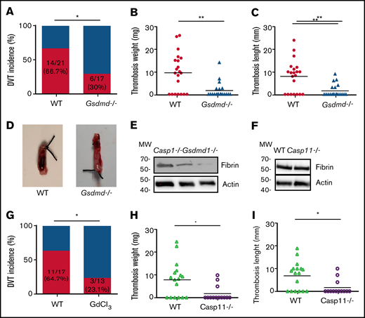 Inflammasome activation triggers venous thrombosis following IVC ligation. (A-D) WT (n = 16) and caspase-1–deficient mice (n = 17) were subjected to IVC stenosis. Thrombus prevalence (A), thrombus weight (B), and thrombus length (C) were measured at 48 hours after the surgery. Representative images of thrombi are shown in panel D. Lines in dot plots represent medians. ⋆P < .05; ⋆⋆P < .01. The χ2 method was used in panel A and Mann-Whitney U test was used in panels B and C. (E-G) WT mice (n = 14) and caspase-11–deficient mice (n = 14) were subjected to IVC stenosis. Thrombus prevalence (E), thrombus weight (F), and thrombus length (G) were measured at 48 hours after the surgery. (H) Western blot analysis of clots from WT, caspase-1– and caspase-11–deficient mice. IL-1β in the lysates of clots was measured by immunoblot with an anti–IL-1β polyclonal antibody. NS, not significant .