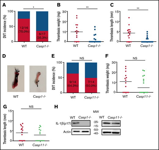 Pyroptosis of monocytes and macrophages is responsible for DVT. (A-D) WT (n = 21) and GSDMD-deficient mice (n = 20) were subjected to IVC stenosis. Thrombus prevalence (A), thrombus weight (B), and thrombus length (C) were measured at 48 hours after the surgery. Representative images of thrombi are shown in panel D. Lines represent the medians. ⋆P < .05; ⋆⋆P < .01. The χ2 method was used in panel A, and Mann-Whitney U test was used in panels B and C. (E) Western blot analysis of clots from WT, caspase-1, and GSDMD-deficient mice. Fibrin in the same amount of tissue lysates was detected by immunoblot with an antifibrin monoclonal antibody (59D8). (F) Fibrin in the same amount of proteins of the tissue lysates from WT and caspase-11–deficient mice was detected by immunoblot with an antifibrin monoclonal antibody (59D8). (G-I) Effect of monocyte depletion on venous thrombosis. C57BL/6J mice administered with GdCl3 (n = 13) or buffer (n = 17) were subjected to IVC stenosis. Thrombus prevalence (G), thrombus weight (H), and thrombus length (I) were measured at 48 hours after the surgery. Lines represent the medians. ⋆P < .05. The χ2 method was used in panel G, and Mann-Whitney U test was used in panels H and I. Ctrl, control.