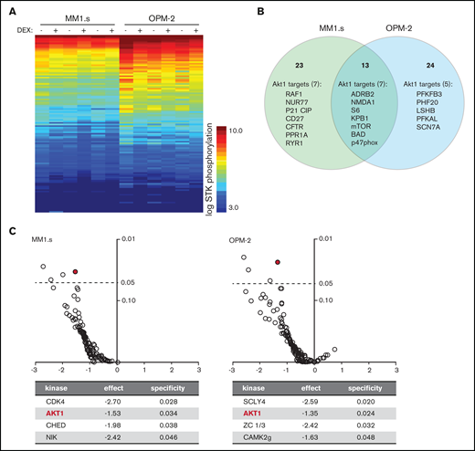Exposure of HMCLs to dexamethasone (DEX) reduces phosphorylation of Akt1 substrates. (A) Heatmap showing STK phosphorylation of peptides in lysates of MM1.s and OPM-2 exposed to 1 μM DEX or dimethyl sulfoxide (DMSO) control for 4 hours. Columns represent 3 technical triplicates per HMCL and treatment condition. Every row represents a unique peptide motif. The log STK phosphorylation is indicated by a color scale in which low phosphorylated peptides are indicated by blue and high phosphorylated peptides by orange/red. (B) Venn diagram depicting total number of peptides with statistically significant reduced phosphorylation in DEX-treated MM1.s (23 unique hits) and OPM-2 (24 unique hits; 13 hits shared between both HMCLs), compared with control cells. Significant hits belonging to Akt1 downstream substrates are specified per HMCL (7 of 23 unique hits for MM1s; 5 of 24 unique hits for OPM-2; 7 of 13 hits shared between both HMCLs). Original data are provided in supplemental Figure 4. (C) Volcano plot of predicted STK activity based on statistically significant dexamethasone-mediated reduction of peptide phosphorylation as shown in supplemental Figure 4, showing fold-difference (x-axis) and specificity (y-axis). Statistical significance with a P value <.05 is indicated by the dashed line. Details are provided for the significant STK’s per HMCL. Akt1 is indicated by the red mark.