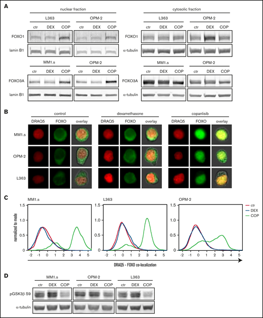 Exposure to dexamethasone (DEX) does not alter FOXO or GSK3β activity in HMCLs. (A) Representative western blot showing FOXO1 and FOXO3a protein expression in nuclear and cytosolic fractions of the indicated HMCLs after 4 hours of exposure to 1 μM DEX, 100 nM copanlisib (COP), or negative control (ctr). α-tubulin and lamin B1 were used as loading controls for cytosolic and nuclear fractions, respectively. (B) Representative image-based flow cytometry image captures by ImageStream at original 60× magnification from indicated HMCLs exposed for 4 hours to DEX 1 μM, COP 100 nM, or negative control. Single images were taken for nuclear dye DR and FOXO (FOXO3a for MM1.s and OPM-2 and FOXO1 for L363) and overlaid with bright-field images. (C) Histograms showing colocalization between DR and FOXO of ImageStream data as obtained in panel B. A positive value indicates similar pixel occupancy, and therefore colocalization, between DR and FOXO, whereas a negative value indicates no similarity in pixel occupancy between both signals. (D) Representative western blot showing expression of GSK3β phosphorylated on serine residue 9 (pGSK3β S9) in indicated HMCLs after 4 hours of exposure to 1 μM DEX, 100 nM COP, or control. α-tubulin was used as a loading control. Quantification findings are given in supplemental Figure 6.