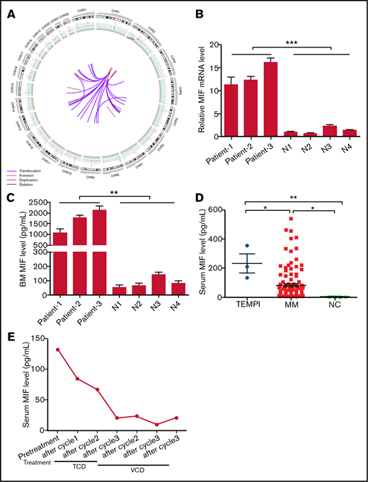 Circos plot of somatic SVs and the expression of MIF in patients with TEMPI syndrome. (A) The center, color lines indicate the presence of translocations and inversions. In the middle ring, the red and black lines indicate presence of duplication and deletion, respectively. The outermost ring indicates chromosome number. (B-D) Expression level of MIF mRNA in CD138+ PCs (B), and secreted MIF protein in BM aspirates (C) from healthy individuals (N) and 3 patients with TEMPI syndrome. (D) The level of serum MIF in healthy individuals (NC) and patients with TEMPI syndrome and multiple myeloma (MM; n = 116). (E) Serum level of MIF in the patient 1 after treatment with TCD and VCD regimen. Statistical analyses were performed using the unpaired Student t test. *P < .05; **P < .01; ***P < .001.