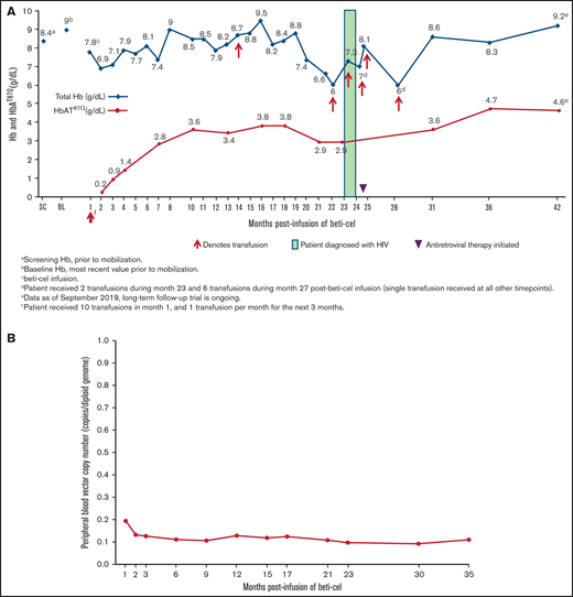Total Hb and HbAT87Q levels and transfusion requirements post–beti-cel infusion. (A) Patient schedule of total Hb (blue diamonds) and HbAT87Q (red circles) measurements relative to transfusions received. Total Hb measurement of <9.0 g/dL was indicated as a common reason for transfusion. (B) Measurements of patient’s peripheral blood VCN levels by month postinfusion. Determination of peripheral blood VCN was performed as a pharmacodynamic measure of treatment efficacy in study HGB-204. In the study population, VCN in peripheral blood mononuclear cells correlated with the production of vector-encoded HbAT87Q-globin levels.1 BL, baseline; Hb, hemoglobin; SC, screening; VCN, vector copy number.