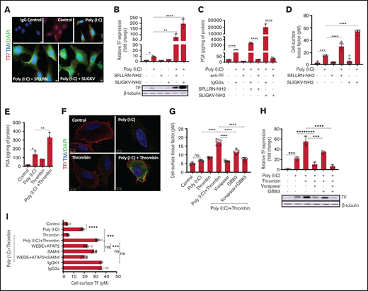 Thrombin-PAR1/2 signaling amplifies cell surface-associated TF procoagulant activity in poly(I:C)-treated cells. (A) EA.hy926 cells were stimulated with poly(I:C) (12.5 μg/mL) and PAR1-selective (SFLLR) or PAR2-selective agonist peptides (150 μM) for 4 hours, and TF and THBD antigen were detected by immunofluorescence in permeabilized cells. Original magnification, ×40; bar represents 10 μm; nuclear counterstain with 4′6-diamidino-2-phenylindole (n = 3). (B) EA.hy926 cells were stimulated with poly(I:C) (12.5 μg/ml) and PAR1 and PAR2 activation peptides for 6 hours in triplicate, and the protein levels of TF and β-tubulin were determined by western blot analysis with the respective antibodies. Data shown in the bar graph represent the mean ± standard deviation of the ratio of TF to β-tubulin, determined by quantitative densitometry of western blots (n = 3) . (C) Cell lysates were prepared from EA.hy926 cells stimulated with poly(I:C) (12.5 μg/mL) and PAR1- and PAR2-activation peptides (150 μM) for 6 hours. TF procoagulant activity (PCA) was measured in the presence or absence of anti-TF antibody (HTF-1; 10 µg/mL) or IgG control (IgG2a; 10 μg/mL) by a 1-stage clotting assay and converted into picograms TF per milligrams protein from a standard curve generated with recombinant TF (Innovin; n = 3). (D) Cell-surface TF activity on intact cells was determined by an fXa generation assay (n = 5-6). (E) EA.hy926 cells were stimulated for 6 hours with poly(I:C) and/or thrombin, and TF procoagulant activity was measured by a 1-stage clotting assay and converted into PCA via a standard curve generated with recombinant TF (Innovin; n = 3). (F) Immunofluorescence detection of cell-surface TF and Thbd antigen on EA.hy926 cells stimulated for 4 hours with poly(I:C) and/or thrombin (original magnification, ×100; bar represents 10 μm; n = 3). (G) EA.hy926 cells were pretreated for 45 minutes with inhibitors of PAR1 (vorapaxar, 1 μM) and/or PAR2 (GB83, 25 μM) followed by stimulation with poly(I:C) and/or thrombin for 6 hours. Cell-surface TF activity was determined by fXa generation (n = 8). (H) EA.hy926 cells were pretreated for 45 minutes with PAR-specific inhibitors (vorapaxar, 1 μM; GB83, 25 μM) followed by stimulation with poly(I:C) and/or thrombin for 6 hours. Abundance of TF and β-tubulin in whole-cell lysates were determined by western blot analysis (n = 3). (I) EA.hy926 cells were pretreated (45 minutes) with cleavage-blocking antibodies for PAR1 (WEDE15, 10 μg/mL; ATAP2, 10 μg/mL) and/or PAR2 (SAM-11, 10 μg/mL), or isotype-matched nonimmune IgG controls followed by stimulation with poly(I:C) and/or thrombin for 6 hours. Cell-surface TF activity was determined via FXa generation assay (n = 4-8). Statistical significance was determined by ANOVA followed by a multiple-comparison test. *P < .05; **P < .01; ***P < .001; ****P < .0001. ns, not significant.