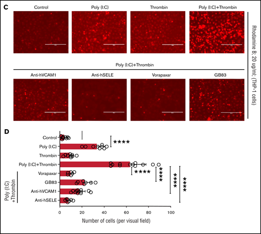 Leukocyte-endothelial interactions. (A) HUVECs were treated with poly(I:C) (12.5 μg/mL) and thrombin (5 nM) for 3 hours, and the abundance of E-selectin and VCAM-1 mRNA relative to GAPDH was measured by quantitative RT-PCR. (B) Representative scatterplots depicting cell surface expression of VCAM-1 and E-selection determined by flow cytometry in HUVECs treated for 4 hours with poly(I:C) and/or thrombin. (C-D) Representative micrographs of static adhesion assay of rhodamine B-labeled THP-1 cells to HUVECs treated with poly(I:C) and/or thrombin, vorapaxar, GB83, or anti-E-selectin– and anti-VCAM1 blocking antibodies (10 μg/mL) and respective nonimmune IgG controls (10 μg/mL). Original magnification, ×20. Brightness adjusted to 75% with Powerpoint picture correction. Bars represent 200 µm. (D) The mean ± standard deviation of adherent THP-1 cells per visual field from 2 independent experiments (n ≥ 9 for control, thrombin, poly(I:C); n ≥ 6 for anti-VCAM-1/E-selectin). *P < .05; **P < .01; ***P < .001; ****P < .0001 by ANOVA, followed by multiple comparison test.