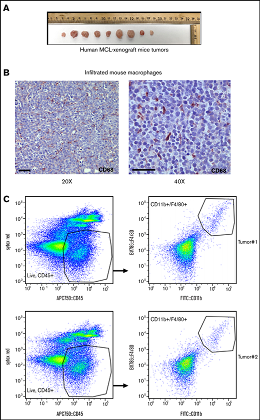 Macrophage infiltration into the MCL xenograft mouse model. (A) NOD/SCID mice were subcutaneously injected with 5 × 106 human MCL cell line Mino, and tumor size is shown after monitoring for 21 days. n = 9 tumors. (B) Macrophage infiltration in the MCL xenograft tumor was assessed by staining tumor sections with anti-CD68, and immunohistochemistry was performed. (C) Infiltrating mouse macrophages (F4/80+/CD11b+) into MCL xenograft tumors were shown by flow analysis as indicated.