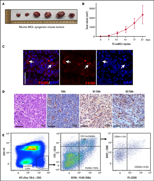 Characterization of TAMs into murine MCL syngeneic mouse model. Immunocompetent C57BL/6 mice were subcutaneously injected with 5 × 106 FC-muMCL1 murine MCL cell line, and images of syngeneic MCL tumors after 21 days (A) and tumor growth curves (B) of the FC-muMCL1 syngeneic tumors are shown (data are presented as mean ± standard deviation; n = 6 mice/group). (C) Immunofluorescent staining was performed on the MCL mouse syngeneic tumors using F4/80 (red) antibody. Nuclei were stained with 4′,6-diamidino-2-phenylindole (DAPI) (blue). (D) Immunohistochemistry was performed on the MCL mouse syngeneic tumors by using specific antibodies against CD68, CD80, and CD206. (E) Dot plots of macrophage populations (CD11b+/F4/80+ and CD80/CD206) with in the MCL mouse syngeneic tumors shown by flow analysis. All staining was performed on at least 2 to 3 mouse tumors, and a representative image is shown. H&E, hematoxylin and eosin.
