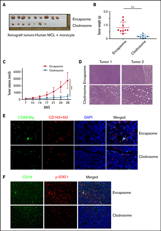 Macrophage depletion abolished the MCL tumor growth in vivo. Tumor size (A), tumor weight (B), and growth kinetics (C) of Mino + CD14+ monocytes (5 × 106, 1:1) implanted subcutaneously into the flank of male NOD/SCID mice with and without 200 µL (5 mg/mL) of Clodrosome or Encapsome (vehicle control) injection. Data are presented as mean ± standard deviation; n = 7 tumors. (D) Hematoxylin and eosin staining of the Clodrosome-treated and untreated mouse xenograft samples. (E) Immunofluorescence showing CD68 and CD163 staining in the Clodrosome- and control-treated mice group. (F) Immunofluorescence staining showing CD19 (green) and p-STAT1 (red) staining in the Clodrosome- and control-treated groups. Data were repeated in 2 mouse tumors, and a representative image is shown. ***P < .001.