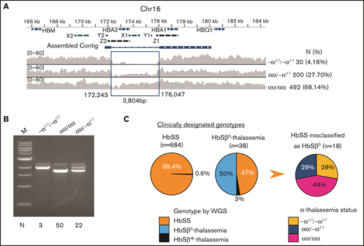 Characterization of α- and β-thalassemia alleles in the SGP cohort. (A) The extended α-globin locus on chromosome 16. The α-globin genes HBA1 and HBA2 are indicated on top. X1 and X2, Y1 and Y2, and Z1 and Z2 represent duplicated regions with high sequence similarity where unequal crossing over generates gene deletions. The α-thalassemia deletion −α3.7 was identified by reduced density of sequencing reads within the indicated assembled contig. The number and percentage of −α3.7 homozygotes and heterozygotes identified in the SGP cohort are shown at right. (B) Agarose gel fractionation of multiplex PCR products show wild-type α globin and −α3.7 alleles.31 We analyzed the genotypes of 75 randomly chosen samples by PCR (indicated at the bottom of the panel) to validate WGS calls for heterozygous or homozygous −α3.7. (C) Discrepancy between clinical assignments and genetic determinations of HbSS and HbSβ0 thalassemia genotypes in the SGP cohort. The first 2 pie charts show the WGS-derived genotypes of individuals who were previously assigned clinical diagnoses of HbSS or HbSβ0-thalassemia. The third pie chart shows the α-thalassemia status of 18 individuals in whom HbSβ0-thalassemia was incorrectly diagnosed.