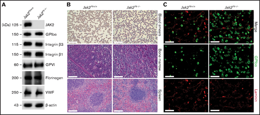 Thrombocytosis and MK hyperplasia in Jak2Plt−/− mice. (A) Jak2Plt+/+ and Jak2Plt−/− platelet lysates corresponding to 2 µg of protein were subjected to SDS-PAGE and probed for the proteins indicated, with β-actin as a loading control. Results are representative of 3 independent experiments. (B) Thin blood smears of Jak2Plt+/+ and Jak2Plt−/− mice. Bars represent 40 µm. H&E staining. Bars represent 80 µm. Sections are representative of 3 mice per genotype. (C) Seven-μm-thick femur bone marrow tissue sections from Jak2Plt+/+ and Jak2Plt−/− mice were immunostained for resident MKs and vasculature using anti-GPIbα (488 nm, green) and anti-laminin (568 nm, red) antibodies, respectively, before fluorescent microscopic analysis. Scale bars, 100 µm. Sections shown are representative of 6 mice per genotype.