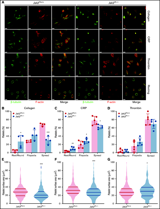 Spreading defects in Jak2Plt−/− platelets.Jak2Plt+/+ and Jak2Plt−/− platelets were left to adhere to 50 µg/mL type 1 collagen or to 100 µg/mL fibrinogen and activated with 1 µg/mL CRP or 0.01 U/mL thrombin glass coverslips for 30 minutes at 37°C as indicated. Fixed platelets were stained for β-tubulin and F-actin (phalloidin) and analyzed by structured illumination microscopy. (A) Representative immunofluorescent micrographs of fixed platelets. Bars represent 3 µm (activated) and 7 µm (resting). (B-D) Morphologic quantification of platelet spreading as determined by resting, extension of defined filopodia, or full spreading in response to collagen (total platelets scored, 549 Jak2Plt+/+ and 311 Jak2Plt−/− in 4 independent experiments) (B); CRP (total platelets scored, 888 Jak2Plt+/+ and 1017 Jak2Plt−/− in 5 independent experiments) (C); or thrombin (total platelets scored, 932 Jak2Plt+/+ and 796 Jak2Plt−/− in 5 independent experiments) (D). Results represent the mean ± SD and were compared by 2-way ANOVA. *P < .05; **P < .01; ***P < .001. (E-G) Violin plots of platelet surface area in response to collagen (total platelets scored, 684 Jak2Plt+/+ and 374 Jak2Plt−/− in 4 independent experiments) (E); CRP (total platelets scored, 918 Jak2Plt+/+ and 1174 Jak2Plt−/− in 5 independent experiments) (F); or thrombin (total platelets scored, 958 Jak2Plt+/+ and 842 Jak2Plt−/− in 5 independent experiments) (G). Results were compared by 2-way ANOVA. *P < .05; ***P < .001.