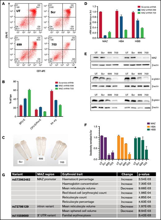 MAZ knockdown impairs erythropoiesis. (A) Flow cytometry analysis of CD71 and glycophorin (GPA) expression at day 15 of representative primary erythroblast differentiation cultures either untransduced (UT) or transduced with lentivirus expressing scramble shRNA (Scr), MAZ shRNA 699, or MAZ shRNA 703. (B) Quantitation of flow cytometry in A. Shown is the mean and standard deviation from 2 independent differentiation cultures. Burst-forming unit-erythroid (BFU-E) are CD71−/GPA−, and colony-forming unit-erythroid (CFU-E)/Proerythroblasts (Pro-E) are CD71+/GPAlo/int and intermediate erythroblasts (Int. ery) are CD71+/GPA+. (C) Cell pellets from primary cultures at d15 of differentiation. Cultures with the MAZ shRNA 699 and 703 are pale compared with Scr control, indicating less extensive hemoglobinization. (D) Real-time RT-PCR analysis of expression of MAZ, HBA and HBB after 15 days of primary erythroid differentiation cultures. Shown is the mean and standard deviation from 2 independent differentiation cultures. For each gene, expression (relative to the PABPC1 gene) is normalized to the mean value observed with scramble shRNA. (E) Western blot analysis of the expression of MAZ, HBA, and HBB after 15 days in 2 independent primary erythroid differentiation cultures. β-actin was used as loading control. (F) Densitometry analysis of the western blots shown in E. For each protein, expression (relative to β-actin) is normalized to the mean value observed with scramble shRNA. (G) Variants around the MAZ locus significantly associated with changes in clinical erythroid traits (adjusted P value < .01). APC, allophycocyanin; PE, phycoerythrin; UTR, untranslated region.