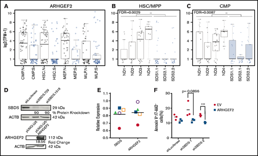 ARHGEF2 is significantly downregulated among differentially expressed genes in SDS HSCs. (A) ARHGEF2 transcript expression within single hematopoietic stem cell (HSC), common myeloid progenitor (CMP), megakaryocyte-erythroid progenitor (MEP), and multilymphoid progenitor (MLP) cells from CD34+ patient samples from normal (N, black) or SDS (S, blue) backgrounds. (B-C) ARHGEF2 transcript expression from individual patient samples within (B) HSC/MPP (FDR = 0.0029) and (C) CMP (FDR = 0.0087) populations. ND and SDS represent normal donor and SDS samples, respectively. Each data point represents a single cell. (D) Western blot validation of shRNAs targeting SBDS (top); ARHGEF2 overexpression (bottom). (E) qPCR assessment of SBDS and ARHGEF2 expression in human CD34+ HSPCs after SBDS knockdown (n = 5 CB samples); each sample is represented by a unique symbol. (F) Flow cytometric evaluation of early apoptosis levels upon concomitant SBDS knockdown and ARHGEF2 overexpression in K562 cells (n = 3 biological replicates evaluated at day 3 of in vitro cultures). Error bars represent standard error of the mean (SEM). EV represents empty vector; **P < .01; ***P < .001.