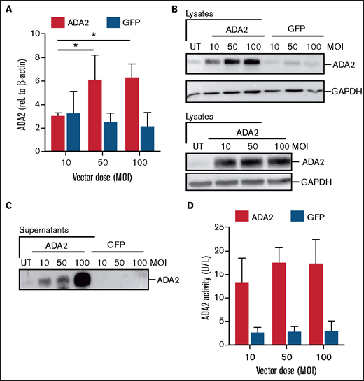 Robust ADA2 expression, secretion, and enzymatic activity in CD34-derived cells after LV-ADA2 transduction. ADA2 expression was measured at transcript (A) and protein (B) levels in expanded CD34-derived cells from HDs that were left UT or transduced with the LV-ADA2 and LV-GFP at an MOI of 10, 50, and 100. GAPDH was included as a loading control. Levels of secreted ADA2 are also shown. ADA2 protein (C) and enzymatic activity (D) were measured in cell-free supernatants collected from cells transduced with LV-ADA2 and LV-GFP at an MOI of 10, 50, and 100. Data are mean ± standard deviation. *P < .05.
