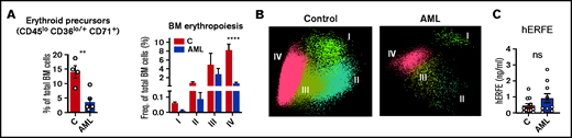 Loss of BM erythroblasts in patients with AML. (A) Flow cytometry analysis of human BM erythroid precursors and of different erythropoiesis stages (I-IV). n = 4 control and 6 patients with AML . (B) Representative automatic population separator diagrams showing multiparametric analysis of flow cytometry data of human erythropoiesis in control and AML patients, based on the markers shown in supplemental Figure 2. (C) Comparison of plasma human erythroferrone (hERFE) in patients with AML at diagnosis (n = 10) and “control” patients (n = 12) with other conditions, mostly lymphoproliferative disorders (supplemental Table 3).