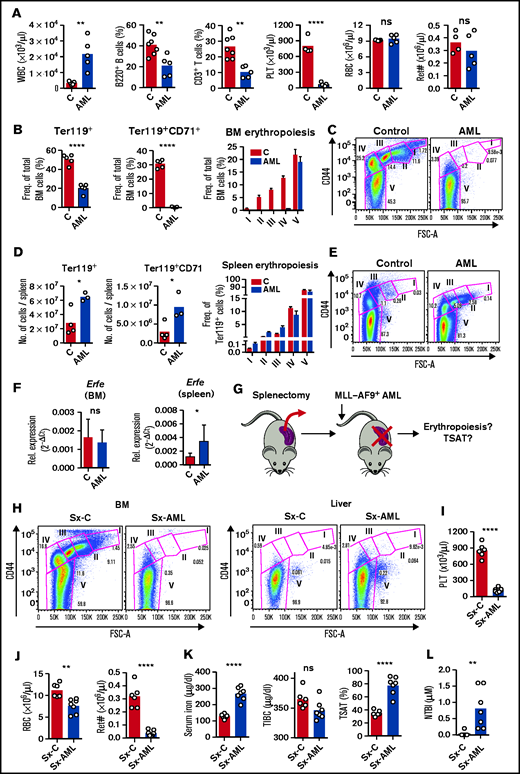 AML-induced loss of erythroblasts causes iron redistribution. (A) Peripheral blood counts for white blood cells (WBC), phenotypically defined B and T cells, platelets (PLT), red blood cells (RBCs), and reticulocyte absolute numbers (Ret#). Each dot represents a mouse. (B) Flow cytometry analysis of BM Ter119+ and Ter119+CD71+ erythroid progenitors and of different erythropoiesis stages (I-V). n = 4 control and 3 AML mice. (C) Representative FACS plots of BM erythropoiesis in control and AML-burdened mice. (D) Flow cytometry analysis of spleen Ter119+ and Ter119+CD71+ erythroid progenitors and of different erythropoiesis stages (I-V). n = 4 control and 3 AML mice. (E) Representative FACS plots of BM erythropoiesis in control and AML-burdened mice. Bone marrow and splenic Erfe (F) expression in control and AML-burdened mice, as assessed by qPCR. n = 7-10 control and 9-10 AML mice wild-type B6 mice were splenectomized (Sx), transplanted (Sx-AML), or not transplanted (Sx-C) (G) with MLL-AF9+ AML and analyzed at full infiltration. (H) Representative FACS plots of BM and liver erythropoiesis in splenectomized mice. Peripheral blood counts for PLT (I) and for RBCs and Ret# (J) in splenectomized mice. Sx-AML had increased SI and TSAT (K) and presence of toxic NTBI (L). Each dot represents a mouse.