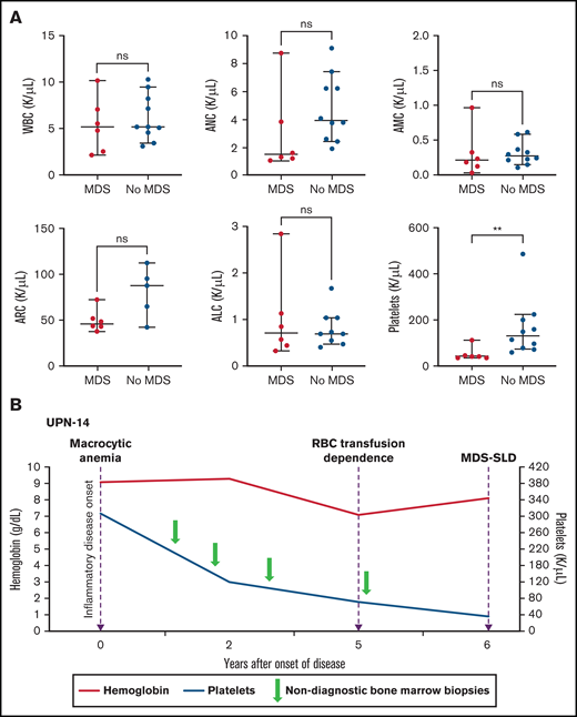 Thrombocytopenia and the risk for MDS in patients with VEXAS. (A) PB counts (from the same timepoint) are compared between patients with MDS diagnosis on BM biopsy and those without MDS diagnosis (at either the last BM biopsy performed or the biopsy before treatment for patients with MM). Median platelet counts at the time of MDS diagnosis were significantly lower (P value 0.0030) compared with those of patients whose BM was not diagnostic of MDS (this included 2 patients with MM). The 2 groups were compared using nonparametric Student t test. The error bars represent the range and middle horizontal bars mark the median. (B) Serial blood counts and BM evaluations for UPN-14 are used as an example to show disease progression. Macrocytic anemia was seen at the onset of inflammatory disease, which progressed over the next 5 years to RBC transfusion dependence. After 5 years, there was steady decline in platelet counts to <50 × 103/µL 1 year later, when the BM biopsy revealed diagnosis of MDS-SLD. Previous BM evaluations did not reveal a diagnosis. ALC, absolute lymphocyte count; AMC, absolute monocyte count; ARC, absolute reticulocyte count.