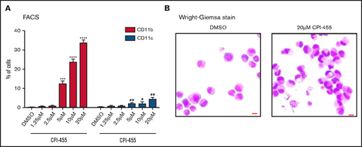KDM5A inhibition induced NB4 differentiation. (A) Differentiation markers CD11b and CD11c in NB4 cells treated with indicated concentrations of a KDM5 inhibitor, CPI-455, measured by using flow cytometry. Statistical significance was determined by using Student’s t test. ***P < .001, ****P < .0001, P values for percentage of CD11b+ cells. #P < .05, ##P < .01, P values for percentage of CD11c+ cells. (B) The morphology of NB4 cells treated with dimethyl sulfoxide (DMSO) or 20 μM KDM5 inhibitor CPI-455. Bar = 15 μm. FACS, fluorescence-activated cell sorting.