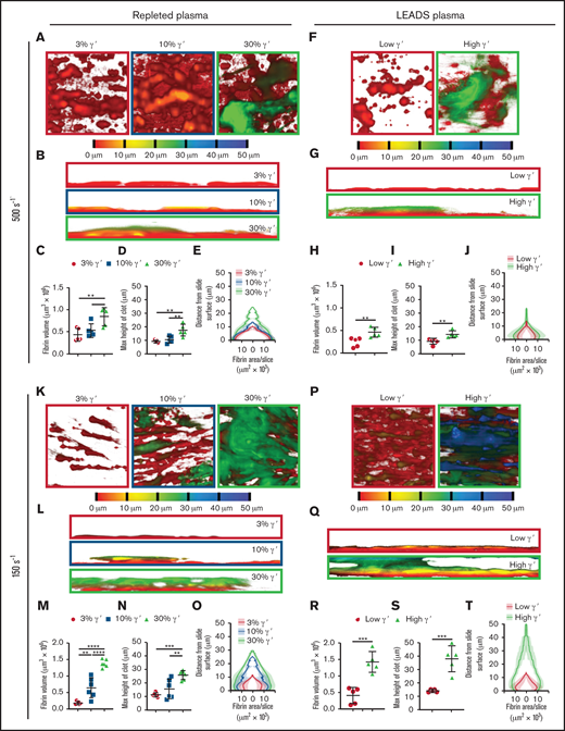 At arterial and venous shear, platelet-dependent fibrin clot size increases as fibrinogen γ′ levels increase within the (patho)physiological range. Following kinetics experiments assessing fibrin deposition, 5 end point images were taken at different locations around the microspot. (A-J) Clots formed under arterial shear (500s−1) and K-T venous shear (150s−1). (A-E,K-O) Experiments carried out using repleted plasma. (F-J,P-T) Experiments carried out using LEADS plasma samples.(A,F,K,P) Representative images of depth-coded z-stack images from above. Images are 213 × 213 μm. (B,G,L,Q) Representative images of depth-coded z-stack images from the side. Images 50 × 213 μm. (C,H,M,R) Total fibrin volume of end point clots. (D,I,N,S) Maximum height of end point clots. (E,J,O,T) Distribution of fibrin represented by area of fibrin per slice vs distance from the clotting surface. Data are mean ± SD. *P < .05, **P < .01, ***P < .001, ****P < .0001, 1-way ANOVA, followed by Tukey’s multiple-comparisons test (C-D,M-N); unpaired Student t test (H-I,R-S).