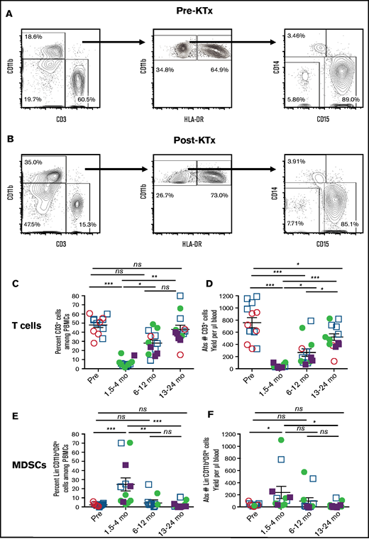 Analysis of T cells and myeloid cells from patients before and after KTx and HCT. Representative 2-color staining of PBMCs before (A) and 9 weeks after (B) transplantation from a single patient. CD19+ B and CD56+ natural killer NK cells were gated out before identifying CD3+ T and CD11b+ myeloid cells (left panels). Lineage negative (Lin− = CD3−CD19−CD56−) CD11bhi myeloid cells are enclosed in boxes to identify phenotypic MDSCs (CD11bhiDRlo) and monocytes (CD11bhiDRhi) (middle panels). Further analysis of the phenotypic MDSCs for expression of CD14 monocytic vs CD15 granulocytic/pmn markers are shown (right panels). The percentage of cells in each box is indicated. Mean percentage (C) and absolute numbers (D) of T cells. Mean percentage (E) and absolute numbers (F) of total MDSCs pre vs posttransplant. HLA-matched recipients are represented as circles, HLA-mismatched recipients are represented as squares. Filled symbols indicate that the recipients were mixed chimeric (>5% donor type cells in whole blood), and open symbols indicate that the recipients were not chimeric at the time that the assay was performed. Data are mean ± standard error of the mean for each group. *P < .05, **P < .01, ***P < .001, Mann-Whitney U test of independent means; significance was subsequently determined by 1-way ANOVA, multicomparison analysis with Holm-Sidak correction. ns, not significant (P > .05).