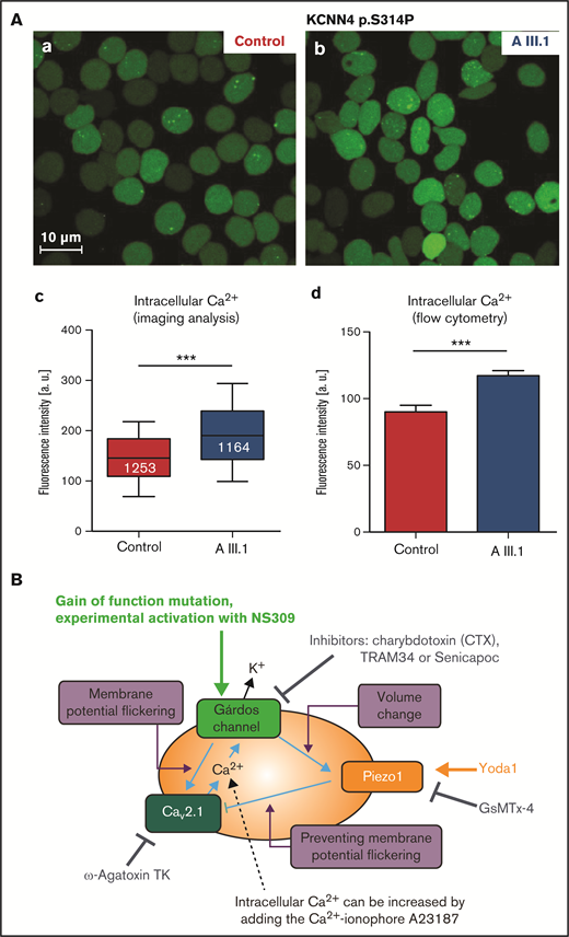 Ca2+ increase in RBCs with Gárdos channel mutations. (A) Ca2+ increase in RBCs of a patient with the p.S314P mutation (AIII.1 in Fermo et al13) in comparison with healthy control RBCs. (a-b) Representative fluorescence images of RBCs stained with Fluo-4; scale bar, 10 μm. (c) Statistical analysis of fluorescent images as depicted in subpanel a. The white numbers refer to the numbers of analyzed cells. (d) Analysis of flow cytometric measurements of Fluo-4–stained RBCs. Statistical differences were checked with a Student t test; *** P < .001. (B) Mechanistic hypothesis regarding how Gárdos channel activity may trigger an increase in intracellular RBC Ca2+ concentration. The membrane potential changes induced by the opening of the Gárdos channel (cp. explanation in "Results and discussion") activates the voltage-gated Ca2+ channel CaV2.1, possibly modulated by the mechanosensitive Piezo1 channel. If Piezo1 is blocked, the Gárdos channel–induced opening of CaV2.1 would be maximal. In contrast, Piezo1 activity, due to the nonselective cation permeability of the channel, would “dissipate” the Gárdos channel–induced hyperpolarization. As a consequence, CaV2.1 activity would be reduced. The scheme contains annotations for the experimental manipulations of the molecular players. An arrow refers to activation and an anchor to inhibition of the transport protein.