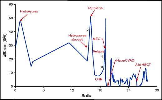 WBC count vs time (in months) with major events labeled. The numerals 1 to 4 indicate corresponding time points of correlative analyses. Allo HSCT, allogeneic hematopoietic stem cell transplantation; CHR, complete hematologic remission; hyperCVAD, cytarabine, vincristine, doxorubicin, dexamethasone; MEC, mitoxantrone, etoposide, cytarabine.