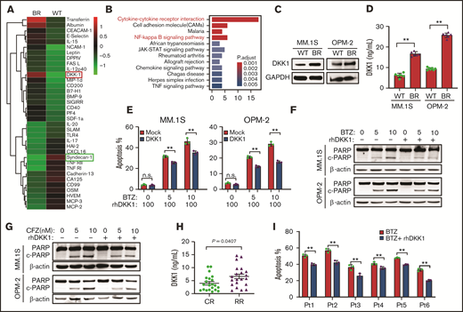 DKK1 promotes MM cell malignancy. (A) Heat map shows selected up- and downregulated cytokines of the WT and BR MM.1S cells. (B) Kyoto Encyclopedia of Genes and Genomes analysis highlights the upregulated or downregulated signaling pathways in the BR MM.1S cells. (C) Representative protein levels of DKK1 in WT and BR MM cells. (D) DKK1 levels in WT and BR MM.1S and OPM-2 cells measured by ELISA (n = 12). (E) Quantification of apoptotic MM cells treated with increasing dosage of BTZ (0-10 nM) with or without 100 ng/mL recombinant human DKK1 for 48 hours (n = 3). (F) Cleavage of PARP as the apoptotic marker in MM cells treated with or without rhDKK1 (100 ng/mL), combined with increasing dosage of BTZ and CFZ (G) for 24 hours (n = 3). (H) DKK1 levels in bone marrow plasma cell (BMPC) from patients with CR (n = 12) and RR patients RR (n = 12) measured by ELISA. (I) Quantification of apoptosis in CD138+ cells from 6 MM patients treated with BTZ (5 nM) with or without 100 ng/mL rhDKK1 for 12 hours.