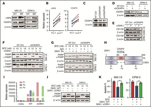 DKK1 induces drug resistance via receptor CKAP4. (A) Representative protein levels of LRP6 and CKAP4 in WT and BR MM cells. (B) LRP6 and CKAP4 expression in 6 patients with disease progression before and after BTZ-based treatment. (C) Western blotting shows the efficacy of 2 shRNAs targeting CKAP4 in HEK293T cells, and validates the knockdown efficacy of shRNA#1 in MM cells (D). (E) Representative of CD138 protein level in MM cells stably expressing shRNA targeting CKAP4 or non-target control (NT Ctrl), and subsequently treated with rhDKK1 (100 ng/mL) for 48 hours. (F) Western blotting shows the cleavage of PARP as a marker of apoptosis in MM cells stably expressing NT Ctrl or CKAP4-shRNA (CKAP4 KD) treated with BTZ and rhDKK1, or anti-DKK1 (G) for 24 hours. (H) Schematic illustration of CRD1 domain deletion in human DKK1 gene, and positions of 3 primers to validate the expression of truncations. CRD1, cysteine-rich domain; FL, full length; P1, position for primer 1; P2, position for primer 2; P3, position for primer 3 for the real-time PCR. (I) qPCR data shows DKK1 FL or ΔCRD1 truncation expressions using 3 different primers. (J) Cleavage of PARP in MM.1S and OPM-2 cells treated with FL or ΔCRD1 DKK1 in presence of BTZ for 24 hours. (K) Quantification of apoptotic MM.1S and OPM-2 cells treated with BTZ in presence of FL DKK1 or ΔCRD1 DKK1.