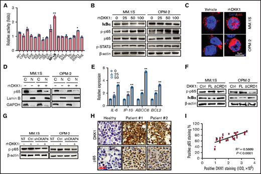 DKK1 activates NF-KB signaling pathway by CKAP4 receptor in multiple myeloma. (A) Fold changes in activations of 17 signaling pathways treated with PBS or rhDKK1 (100 ng/mL) for 24 hours in MM.1S cells. (B) Phosphorylation levels of p65 and STAT3, total IκB-α in MM.1S and OPM-2 cells treated with increasing dosage of rhDKK1 (0-100 ng/mL) for 1 hour. (C) Immunofluorescence staining to detect the nuclear localization of p65 in MM.1S and OPM-2 cells treated with PBS or rhDKK1 (100 ng/mL) for 12 hours. Scale bar, 5 μm. (D) Cytoplasmic and nuclear fraction of p65 in MM.1S and OPM-2 cells treated with PBS or rhDKK1 (100 ng/mL) for 12 hours. (E) qPCR detecting downstream target genes of NF-κB signaling under the stimulation of rhDKK1 (100 ng/mL) for 12 hours. (F) Levels of p-p65 and IκB-α protein in MM.1S and OPM-2 cells treated with full-length (FL) rhDKK1 or CRD1 domain depletion DKK1 (ΔCRD1) for 12 hours. (G) Levels of p-p65 and IκB-α protein in MM.1S and OPM-2 cells with CKAP4 receptor knockdown and treated with rhDKK1 (100 ng/mL) for 12 hours. (H) Immunohistochemistry staining of DKK1 and p65 proteins in the sequential slides of bone marrow biopsies from 2 patients and healthy donor. Scale bar, 20 μm. (I) Correlation coefficient between positive rate of p65 and DKK1 intensity in bone marrow tissues from MM patients (n = 12).