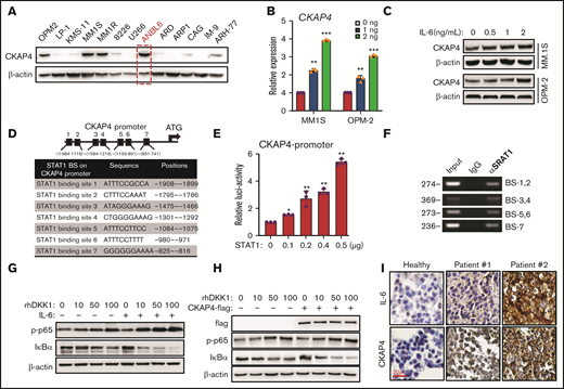 CKAP4 is under regulation of IL-6. (A) Western blotting shows CKAP4 levels in 13 myeloma cell lines. Red, IL-6–dependent cells. (B) CKAP4 mRNA expressions in MM.1S and OPM-2 cells treated with increasing dosage of IL-6 for 24 hours, and shows the protein levels (C). (D) Schematic illustration of STAT1 binding sites (BS), sequences and positions on the CKAP4 promoter. (E) Luciferase assay of a 1050-bp hCKAP4-promoter in HEK293T cells co-transfected with increasing amount of STAT1 plasmid. (F) The STAT1 BS on the CKAP4 promoter in MM.1S cells by ChIP-PCR. (G) Levels of p-p65 and IκB-α in MM.1S treated with increasing dosage of DKK1 with or without IL-6, or with or without CKAP4 overexpression (H) for 1 hour. (I) Immunohistochemistry staining of IL-6 and CKAP4 proteins in bone marrow biopsies from 2 patients and healthy donor. Scale bar, 100 μm.