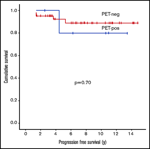 PFS in limited-stage NLPHL patients by interim PET2 result (Deauville criteria) (n = 49; P = .70). neg, negative; pos, positive. There was no significant difference in PFS between PET-negative and PET-positive patients.
