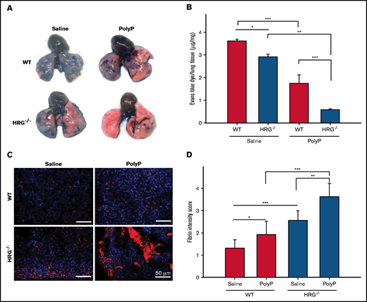 Comparison of the effect of IP polyP on perfusion and fibrin deposition in the lungs of wild-type (WT) or HRG-deficient mice. (A) Evans blue dye was injected into the right ventricle of WT or HRG−/− mice administered IP saline or polyP. Images of the lungs were taken to examine the extent of dye perfusion into the lungs. Representative images from 6 mice per group are shown. (B) Evans blue dye extracted from lungs with formamide was quantified by measuring absorbance at 605 nm and calculating the amount of dye per microgram of tissue by comparison with a standard curve. N = 6 mice per group; bars represent mean ± standard deviation. (C) Fibrin deposition (red) in lung sections was detected by immunofluorescence with 4′,6-diamidino-2-phenylindole (blue) serving as a nuclear stain. Scale bars represent 50 μm. Representative images from six mice per treatment group are shown. (D) Fibrin intensity was scored in a blinded manner by using a scale of 0 to 4, with 4 representing the greatest intensity. N = 6 mice per group; bars represent mean ± standard deviation. *P < .05, **P < .01, ***P < .001 comparison between saline- or polyP-treated WT or HRG−/− mice as indicated by the lines (analysis of variance, Holm-Šídákmethod).