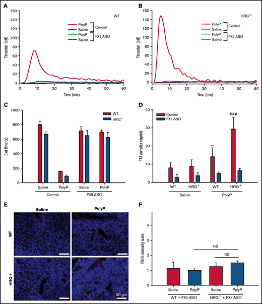 Effect of FXII knockdown on the procoagulant and prothrombotic effects of polyP in wild-type (WT) or HRG-deficient mice. Thrombin generation was measured in plasma collected 60 minutes after IP saline or polyP treatment of WT mice (A) or HRG−/− mice (B) without (control) or with FXII knockdown by ASO treatment. N = 8 mice per group. (C) Recalcification times were measured in plasma collected 60 minutes after WT or HRG−/− mice without or with FXII knockdown were given IP saline or polyP. N = 8 mice per group; bars represent mean ± standard deviation (SD). (D) Thrombin-antithrombin (TAT) complex levels in plasma from WT or HRG−/− mice without (red bars) or with FXII knockdown (blue bars). N = 8 to 9 mice per group; bars represent mean ± SD. (E) Fibrin deposition (red) in lungs from WT or HRG−/− mice without or with FXII knockdown was identified by immunofluorescence using an anti-fibrin(ogen) antibody. 4′,6-Diamidino-2-phenylindole (blue) was used as a nuclear stain. Scale bar represents 50 μm. (F) Fibrin intensities in panel E were quantified in a blinded manner by using a scale of 0 to 4. N = 8 mice per group; bars represent mean ± SD. **P < .01 compared with WT mice with FXII knockdown given saline; ###P < .001 compared with HRG−/− mice with FXII knockdown given saline (analysis of variance, Holm-Šídák method). NS, not significant.