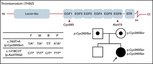 Structure of the thrombomodulin gene (THBD) and identification of 2 missense variants in the patient and her parents. The c.793T>A substitution causes the p.Cys265Ser missense substitution in EGF-like domain 1, and c.1418C>T causes p.Ala473Val in EGF-like domain 6. The patient’s parents were both heterozygous for the c.793T>A variant, whereas her brother did not carry it. Nt, N terminus; STR, Ser/Thr-rich domain; tm, transmembrane domain; Ct, C terminus; F, father; M, mother; B, brother; P, proband. *Novel variation. #Common polymorphism.