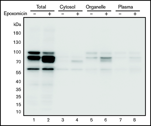 TM levels after treatment of cells with epoxomicin. Cells expressing the TM-C265S mutant protein were cultured in the absence or presence of the proteasome inhibitor epoxomicin for 11 hours. TM protein was subsequently detected after separation by SDS-PAGE and western blot analysis with an anti-His tag antibody. Total, cell lysates; Organelle, organelle membranes; Plasma, plasma membranes.