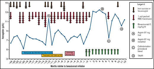 Hemoglobin, hematologic support, and bleeding-directed systemic therapies. The patient required multiple pRBC transfusions on almost a monthly basis to maintain her hemoglobin despite multiple attempted therapies. She was trialed on aspirin therapy at month −12 but continued to have refractory GI bleeding. After starting treatment with bevacizumab 5 mg/kg at time 0, she became transfusion independent and successfully tolerated aspirin, which allowed for her TAVR. TID, 3 times per day.