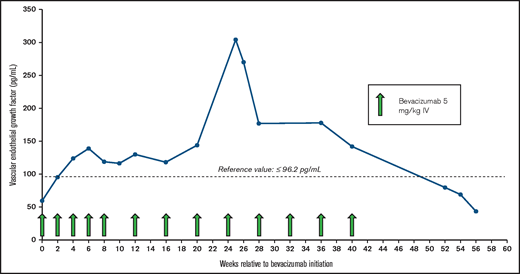 Plasma VEGF levels and bevacizumab treatment course. Plasma VEGF-A levels increased during treatment and normalized after bevacizumab was discontinued. Reference value, ≤96.2 pg/mL. IV, intravenous.