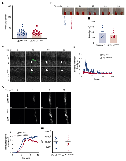 Functional role of SLFN14 in thrombosis. (A) Tail bleeding time assay. Two to 3 millimeters of tail was removed, and bleeding time until first stop was measured. Each data point represents 1 animal; n = 18 to 20 mice per genotype. (B) Clot retraction of SLFN14K208N/+ mouse platelets in PRP. Clots were formed by stimulating 2 × 108 platelets per milliliter with 0.1 U/mL thrombin; monitoring took place for 2 hours. Representative images (Bi) and final clot weight (Bii). Data are mean ± SEM; n = 8 or 9 mice per genotype. (C) Laser-induced thrombus formation in vivo. (Ci) Representative composite brightfield and fluorescence images of thrombus formation. Mice were injected with anti-GPIbβ DyLight488 (0.1µg/g body weight). Arterioles of the cremaster muscle were subsequently injured by laser (arrowheads) and thrombi fluorescence was measured. Scale bars, 10 µm. (Cii) Graph showing median integrated thrombus formation fluorescence intensity in arbitrary units (a.u.) for 31 or 32 injuries in 4 mice per genotype. (D) FeCl3-induced thrombus formation. Mice were injected with DyLight488-conjugated anti-GPIbβ antibody (0.1 µg/g body weight), and the carotid artery was subsequently injured with 10% FeCl3 solution for 3 minutes. (Di) Representative fluorescence images of platelets (GPIbβ). Scale bars, 200 µm. (Dii) Graph showing median integrated thrombus fluorescence. (Diii) Area under the curve (AUC) of the integrated fluorescence density (in a.u). Data are mean; n = 11 or 12 mice per genotype. See supplemental Videos 3 and 4 for wild-type and mutants, respectively.