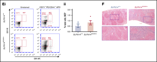 SLFN14K208N/+mice exhibit splenomegaly and extramedullary erythropoiesis. (Ai) Representative images of spleens from SLFN14K208N/+ and SLFN14+/+ mice. (Aii) Normalized spleen weight. Spleen weight/body weight (mg/g) from 8 or 9 mice per genotype. (Bi) Representative images of H&E-stained spleen sections from SLFN14K208N/+ and wild-type controls. Arrowheads indicate MKs. Scale bars, 50 µm. (Bii) Quantification of MK number per field of view. n = 3 mice per genotype, 10 or 11 fields of view per tissue sample. Analysis was conducted blind. (C) Quantification of MKs in spleen. (Ci) MK staining: MKs were identified by CD41 (αIIb) allophycocyanin (APC) and CD42 (GPIb) fluorescein isothiocyanate (FITC) double staining. (Cii) Proportion of MKs in spleen flow cytometry. (D) Quantification of erythroid progenitors in spleen. (Di) ProE staining: ProEs were identified as double-positive CD71 (transferrin receptor 1) phycoerythrin (PE) and Ter119 FITC cells (ProE gate). (Dii) Quantification of ProEs, increased Ter119+ cell population in SLFN14K208N/+ mice, and profile of Ter119hi cells by EryA, EryB, and EryC gates. (E) Quantification of MK-EB–primed MEPs in the spleen: MEPs were identified as a small population positive for CD71 (transferrin receptor 1) PE and CD41 (αIIb) APC (MEP). (Ei) Flow cytometry plots show a slight, but insignificant, increase in MEP cell numbers in SLFN14 K208N mice compared with wild-type. (Eii) MEP quantification. All spleen flow cytometry data and quantification are representative of 4 or 5 mice per genotype/staining condition. (F) Representative images of hemosiderin deposits in spleen sections of wild-type and SLFN14K208N/+ mice highlighted by Perls Prussian blue staining. Scale bars, 50 µm. n = 3 mice per genotype. *P < .05, **P < .01, Student t test.