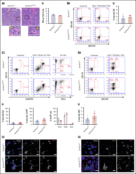 Bone marrow progenitor profile of SLFN14K208N/+mice. (Ai) Representative images of H&E-stained femur sections from SLFN14K208N/+ and SLFN14+/+ mice. Femurs were fixed in 4% formaldehyde and decalcified before sectioning, staining and quantification of MK number per field of view. MKs are indicated by arrowheads. Scale bars, 50 µm. (Aii) Quantification of MK number per field of view from 3 mice per genotype. Two femurs per mouse were sectioned, and 10 to 13 fields of view per section were quantified blind. Students t test was used to assess significance. (B) Quantification of MKs in bone marrow. (Bi) MK staining: MKs were identified by CD41 (αIIb) allophycocyanin (APC) and CD42 (GPIb) fluorescein isothiocyanate (FITC) double staining. (Bii) Quantification of MKs in whole bone marrow by flow cytometry. (C) Quantification of erythroid progenitors in bone marrow. (Ci) ProE staining: ProEs were identified as double-positive CD71 (transferrin receptor 1) phycoerythrin (PE) and Ter119 FITC cells (ProE gate). Maturation of ProEs to mature erythrocytes can be monitored by Ter119hi expression and loss of CD71 expression (EryB and EryC gates). Note the spread of intermediate cells in EryBs, supporting evidence for an altered EryB fate in heterozygotes. (Cii) Quantification of erythroid progenitors in the bone marrow. (Ciii) Confocal images of flow cytometry samples show a double-positive ProE population. Ter119 Alexa Fluor 488 and CD71 Alexa Fluor 647 and DAPI counterstain. Scale bars, 50 µm. (D) Quantification of MEPs in bone marrow. (Di) MK-EB–primed MEPs: MEPs were identified as a small population positive for CD71 (transferrin receptor 1) PE and CD41 (αIIb) APC (MEP). Flow cytometry plots show a slight, but insignificant, increase in MEP cell numbers in SLFN14 K208N mice compared with wild-types. (Dii) MEP quantification in the bone marrow. Staining for these markers highlights MEP cells preferential to the MK or EB lineage. (Diii) Representative images of CD41 Alexa Fluor 488 and CD71 Alexa Fluor 647 stained bone marrow cells imaged by confocal microscopy and using DAPI counterstain. Scale bars, 50 µm. All bone marrow flow cytometry data and quantifications are representative of 4 to 6 mice per genotype/staining condition.