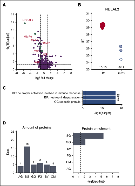 Neutrophils from patients with GPS show lower SG protein abundance compared with healthy control neutrophils (PMNs). (A) Volcano plot comparing PMN proteomes of patients with GPS vs healthy controls (HC). (B) Label-free intensity values of PMN of patients with GPS vs HCs. The white and red circles indicate patients 1, 7, and 8 in supplemental Figure 3, respectively. (C) GO term enrichment analysis of proteins with decreased abundancies in PMNs of patients with GPS. (D) Distribution of granule-annotated proteins with decreased abundancies in PMNs of patients with and corresponding granule protein enrichment analysis. BP, biological process; CC, cellular component.; CM, cell membrane; FG, ficolin-1-rich granule; LFQ, label free quantification; SV, secretory vesicle.