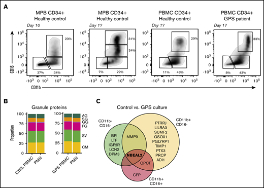 Proteomic comparison of control and GPS CD34+HSC-derived neutrophil culture. (A) Representative plots of the 3 isolated cell populations obtained by fluorescence-activated cell sorting based on cell surface markers CD11b and CD16 from control or GPS CD34+ HSC-derived cells at day 10 or 17 of the cell culture. (B) Stacked bar plots showing proportions of measured granule protein content between control (CTRL) PBMC CD34+ HSCs cultured CD16POS vs blood-derived PMNs (left panel) and GPS PBMC CD34+ HSCs cultured CD16POS vs blood-derived PMNs (right panel). (C) Comparisons among proteomes of the 3 different development stages (CD11bNEGCD16NEG, CD11bPOSCD16NEG, and CD11bPOSCD16POS) at the end of differentiation from the CD34+ HSC cultures derived from healthy controls or patients with GPS.
