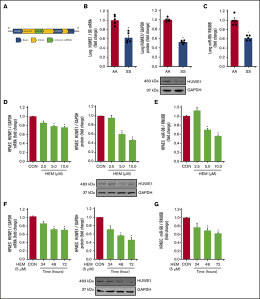 HUWE1 and miR-98 levels are reduced in lungs of SS mice in vivo and in HEM-treated HPAECs in vitro. (A) Schematic illustration of intronic miR-98 on the host gene HUWE1 on chromosome X. (B-C) Whole lung homogenates were collected from littermate control (AA) and SS mice. Lung HUWE1 mRNA and protein (B) and miR-98 (C) levels were measured with real-time qPCR or western blotting and expressed relative to lung mRNA (9S mRNA), protein (GAPDH), and RNU6B (miRNA). *P < .05 vs AA, n = 5. (D-E) HPAECs were treated with DMSO vehicle (CON) or HEM (2.5, 5.0, and 10.0 µM) for 72 hours. Mean HPAEC HUWE1 mRNA and protein (D) and miR-98 (E) levels were measured with real-time qPCR or western blotting. (F-G) HPAECs were treated with DMSO vehicle (CON) or HEM (5 µM) for 24, 48, and 72 hours. Mean HPAEC HUWE1 mRNA and protein (F) and miR-98 (G) levels were measured with real-time qPCR or western blotting. Each bar represents the mean HUWE1 and miR-98 level ± SEM relative to GAPDH or RNU6B expressed as fold change vs CON. *P < .05 vs CON, n = 6.