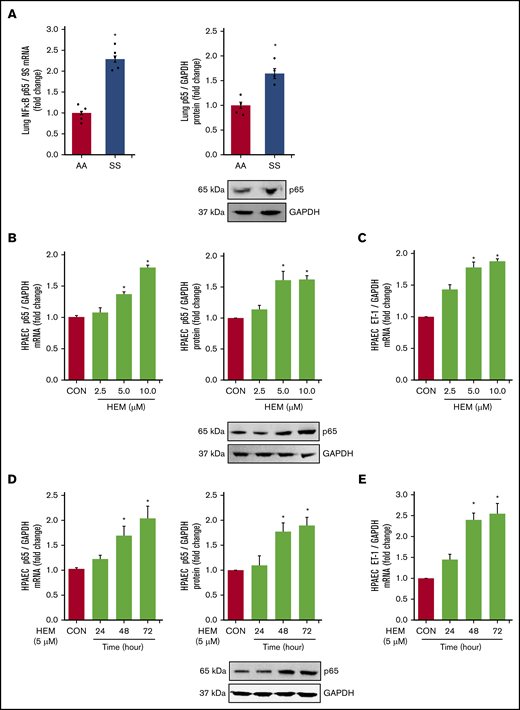 NF-κB/p65 levels are increased and HUWE1 levels are reduced in lungs of SS mice in vivo and in HEM-treated HPAECs in vitro. (A) Whole lung homogenates were collected from littermate control (AA) and SS mice. Lung NF-κB/p65 mRNA or protein levels were measured with real-time qPCR or western blotting and expressed relative to lung mRNA (9S mRNA) or protein (GAPDH). *P < .05 vs AA, n = 4 to 5. (B-C) HPAECs were treated with DMSO vehicle (CON) or HEM (2.5, 5.0, and 10.0 µM) for 72 hours. (D-E) HPAECs were treated with DMSO vehicle (CON) or HEM (5 µM) for 24, 48, and 72 hours. Mean HPAEC NF-κB/p65 mRNA or protein (B) and ET-1 mRNA (C) levels were measured with real-time qPCR or western blotting. Each bar represents the mean NF-κB/p65 or ET-1 level ± SEM relative to GAPDH expressed as fold change vs CON. *P < .05 vs CON, n = 6. (D-E) HPAECs were treated with DMSO vehicle (CON) or HEM (5 µM) for 24, 48, and 72 hours. Mean HPAEC p65 mRNA and protein (D) and ET-1 (E) protein levels were measured with real-time qPCR or western blotting. Each bar represents the mean p65 or ET-1 level ± SEM relative to GAPDH expressed as fold change vs CON. *P < .05 vs CON, n = 6.