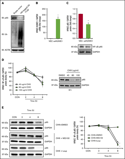 NF-κB/p65 is degraded by ubiquitination. (A) HPAECs were transfected with either the CON plasmid (empty VEC) or HA-ubiquitin (HA-Ubi; 1 µg) plasmid for 24 hours. HPAECs were collected and assayed for HA, p65, and β-actin (loading CON, ACTB) by immunoblotting. (B-C) HPAECs were transfected with either the CON plasmid (VEC) or HUWE1 (1 μg, oxHUWE1) plasmid for 6 hours; Media were replaced with EGM containing 5% FBS and then incubated for an additional 72 hours. (D) CHX treatment was carried out at a concentration of 40 to 100 μg/mL at varying time points (0-8 hours) in 0% FBS medium. (E) HPAECs were pretreated with DMSO or MG132, and leupeptin (Leup) for 2 hours and treated with CHX (40 µg/mL) for 0, 2, 4, and 8 hours to inhibit de novo protein synthesis and harvested for western blotting. The levels of p65 at time 0 was set as 100%, and the percent p65 protein remaining following CHX treatment at each time point was calculated accordingly. ACTB, actin beta.