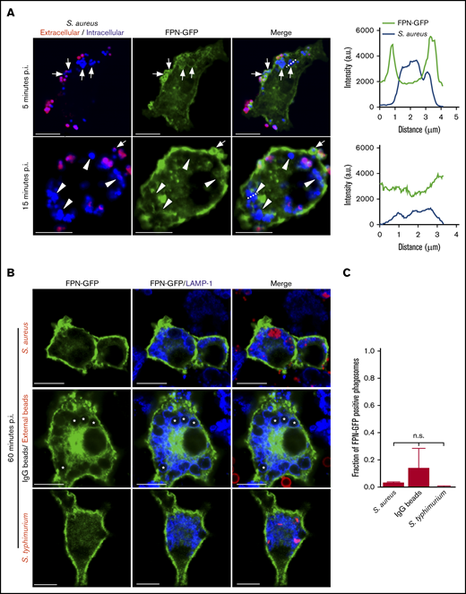 FPN is transiently present on phagosomes containing S aureus. (A) Confocal images of RAW macrophages expressing FPN-GFP (in green) having been exposed to live eFluor-670–labeled S aureus (in blue) for 5 and 15 minutes are shown. Bacteria that were extracellular at 5 minutes were marked with a TRITC-conjugated secondary antibody (in red). Arrows point to phagocytosed S aureus that are demarcated by GFP fluorescence at 5 minutes. In the bottom panels, the arrowheads point to phagocytosed S aureus that are not demarcated by GFP at 15 minutes. The white arrow points to an S aureus coccus that is enveloped by GFP at the same time point; however, the presence of TRITC fluorescence indicates this bacterium was engulfed after the 5- minute time point. The dashed lines indicate the areas of the cell analyzed by the line scans that are presented to right of the micrographs for 5 minutes (top graph) and 15 minutes (bottom graph). Scale bars, 10 μm. (B) The localization of FPN-GFP to phagosomes containing S aureus expressing mCherry (top row, in red), IgG-opsonized latex beads (middle row), and S typhimurium expressing RFP (bottom row, in red) at 1 hour postphagocytosis is shown. IgG-opsonized beads remaining extracellular at 1 hour were marked with an anti-human Cy3-conjugated antibody and are in red (middle panel). Cells were also immunostained for endogenous LAMP-1 (in blue). Scale bars, 10 μm. (C) The fraction of FPN-GFP–positive phagosomes at 1 hour postphagocytosis is plotted for the 3 distinct phagocytic targets shown in panel B. These data are the mean ± SD from 3 independent experiments. Statistical significance was determined using an ordinary 1-way analysis of variance and a Tukey multiple comparison. n.s., not significant. (A-B) The images were acquired from fixed samples at the indicated times using laser scanning confocal microscopy. *Indicates the position of representative bead containing phagosomes. p.i., postinfection.