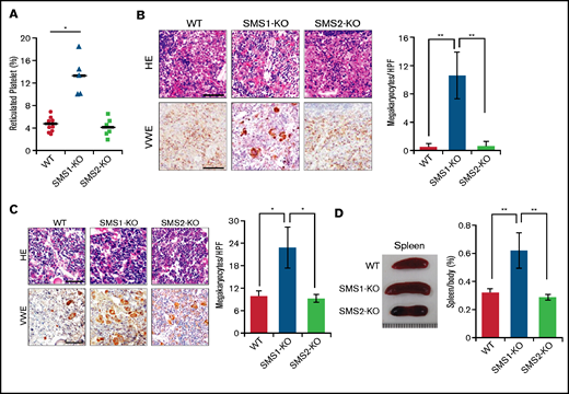 Assessment of extramedullary hematopoiesis and splenomegaly. (A) The reticulated platelets of WT (n = 10), SMS1-KO (n = 5), and SMS2-KO (n = 6) mice were stained with thiazole orange and analyzed by using flow cytometry. Paraffin sections of spleen (B) and bone marrow (C) were stained with hematoxylin and eosin (HE) or with anti-vWF antibody. The vWF-positive MKs in several randomly chosen high-power fields (HPF) were quantified. Scale bars, 50 µm. (D) Representative images of spleens from WT, SMS1-KO, and SMS2-KO mice. The ratios of the spleen to whole body weight were calculated in nine WT, ten SMS1-KO, and seven SMS2-KO mice. Values show the mean ± standard deviation. *P < .05; **P < .005.