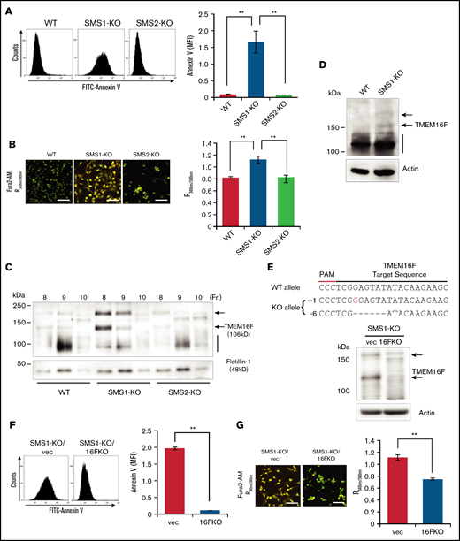 PS externalization and cytosolic Ca2+ level in tMEFs. (A) WT, SMS1-KO, and SMS2-KO tMEFs were stained with FITC–annexin V, and then analyzed with flow cytometry. The fluorescence of FITC–annexin V was quantified as mean fluorescent intensity (MFI). (B) Intracellular Ca2+ levels were measured with Fura2-AM and calcium imaging. The fluorescence was measured with Argus (aHamamtsu Photonics, Hamamatsu, Japan) and is presented as the 340 nm/380 nm fluorescence ratio (R340nm/380nm). Scale bars, 50 µm. (C) The DRM fraction was extracted with lysis buffer containing 1% Brij 58 (Sigma-Aldrich, St. Louis, MO) and OptiPrep (Axis-Shield Alere Technologies, Oslo, Norway) discontinuous gradients (5% and 30%). Fractions were collected from the top to the bottom of the gradient, and the DRM fractions (fractions 8-10) were analyzed by western blot analysis with antibodies against TMEM16F and the lipid raft marker flotillin-1. (D) Western blotting of TMEM16F protein in WT and SMS1-KO platelets was performed. (E) TMEM16F-KO tMEFs were established from SMS1-KO tMEFs by using CRISPER/Cas9 plasmids constructed based on lentiCRISPR-V2. The sequence of TMEM16F is shown at the top with the target sequence and the protospacer adjacent motif (PAM) sequence. Insertions are shown in red, and deletions are shown as black dashes. The change in length caused by each indel mutation is listed to the left of each sequence (+, insertion; −, deletion). TMEM16F protein in the SMS1-KO/TMEM16F-KO (1KO/16FKO) and SMS1-KO/vector (1KO/vec) tMEFs was detected by western blot analysis. Arrows indicate TMEM16F protein. (F) Cell surface PS was stained with FITC–annexin V and then analyzed with flow cytometry. The fluorescence was quantified as MFI. (G) Cytosolic Ca2+ levels were measured with Fura2-AM and are presented as the R340nm/380nm. Scale bars, 50 µm. Values show the mean ± standard deviation. **P < .005.