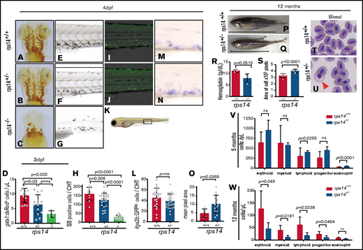 Rps14 stable mutants show dose-dependent effects on hematopoiesis in embryos. (A-C) Assessment of hemoglobinized cells with o-dianisidine staining. Ventral views of the head in 4-dpf embryos. Rps14−/− zebrafish showed profound loss of hemoglobinized cells (C) and developmental anomalies. Rps14+/− were indistinguishable from their WT siblings by microscopy (A-B). (D) Number of erythroid cells by flow cytometry of individual Tg(gata1:dsRed);Rps14+/− embryos at 3 dpf. There was an allelic dose-dependent effect on the dsRed-expressing number of cells. (E-G) SB-stained 4-dpf embryos for granulocytes. (H) Quantification of SB+ cells. (K) Region of CHT depicted in cartoon (adapted from Lizzy Griffiths with permission). SB staining shows an allelic dose-dependent effect of Rps14. (I-J) Lateral views of the CHT of 4dpf Rps14 mutant fish carrying the itga2b:GFP transgene, labeling HSPCs that reside in the CHT. (L) Quantitation of stationary GFPlo cells in the CHT. (M-N) Expression of c-myb by in situ hybridization in 4-dpf embryos. (O) In contrast to itga2b-GFP, c-myb expression is increased in the CHT, quantified by median expression intensity in CHT.58 (P-Q) Lateral views of 12-month-old adult fish show the decreased size of heterozygotes. The anterior faces left and the dorsal side faces upward. The horizontal line shows the body length excluding the tail. (R) Quantification of hemoglobin concentration. (S) Analysis of cell size. Red blood cells were significantly larger in Rps14+/− mutants compared with siblings. (T-U) Micrographs of blood smears from Rps14+/− and WT siblings; the arrowhead indicates poorly hemoglobinized erythroid cell in Rps14+/−. (V-W) Absolute number of cells per microliter of different cell types in the kidney marrow of 5- and 12-month-old fish, showing progressive differences between heterozygous rps14 mutants and their WT siblings. Statistical comparison by 1-way ANOVA with Tukey’s multiple-comparisons test (D,H) or unpaired Student t test. Original magnification x100 for panels T and U.