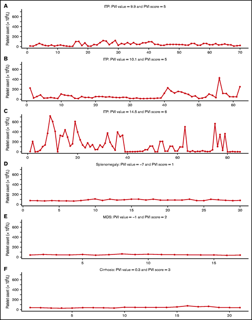 PVI score for 6 patients with thrombocytopenia because of ITP (A-C) and non-ITP thrombocytopenia (D-F).